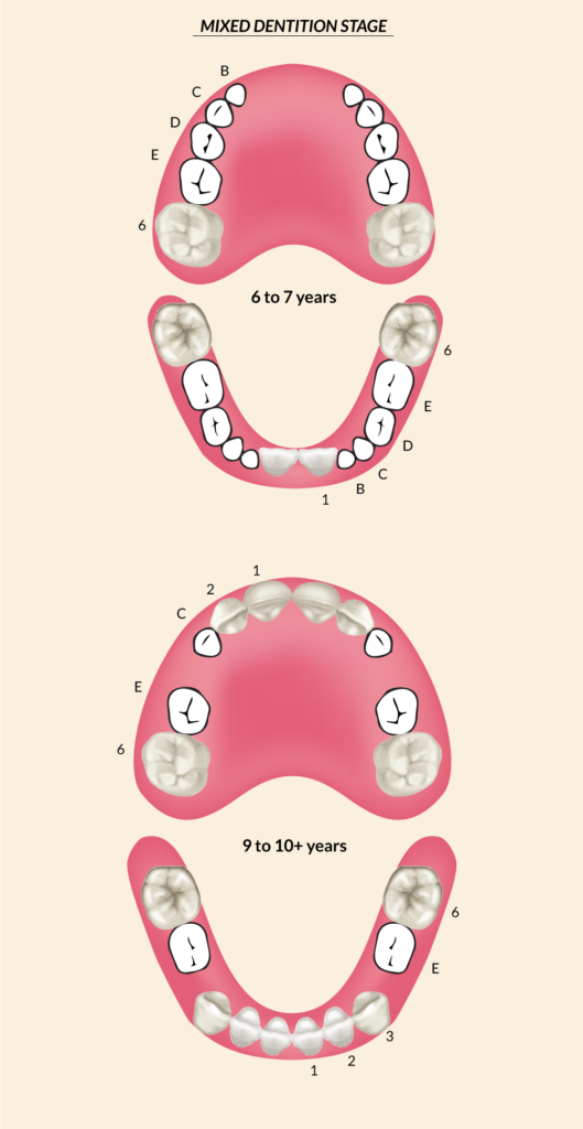 Mixed dentition stage