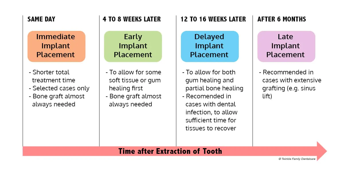 Dental Implant Placement Protocol