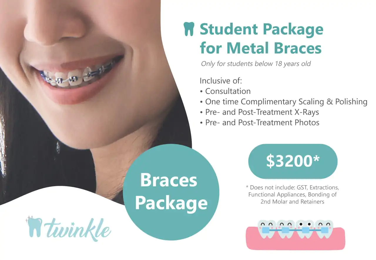student package for metal braces $3200